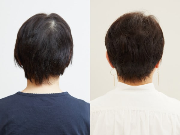 イメチェンビフォーアフター（バック）：佐々木恵子さん（61歳）