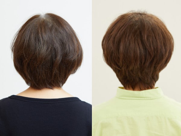 イメチェンビフォーアフター（バック）：土屋文子さん（64歳）