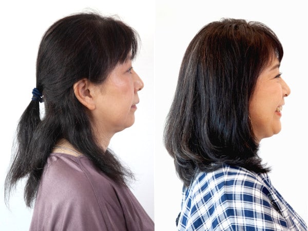 イメチェンビフォーアフター（サイド）：ちはるさん（50歳）