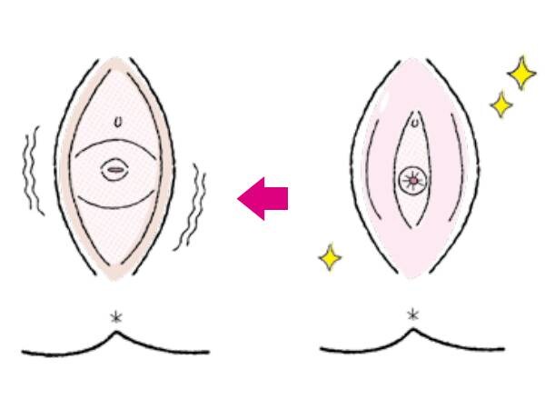 更年期による女性ホルモンの低下が頻尿の一因に