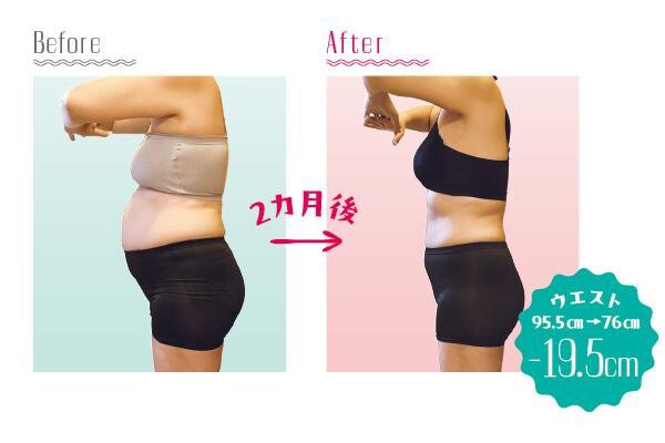 50代でもこんなに変わった！体験者のBefore→After 