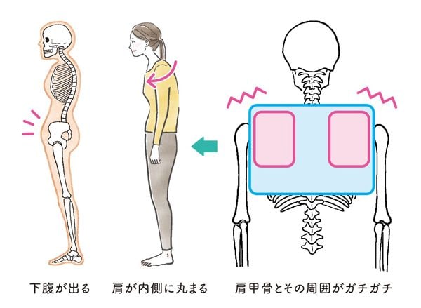 ななめ巻きメソッド（理論編）肩甲骨がゆがむとなぜ「ぽっこり」に？