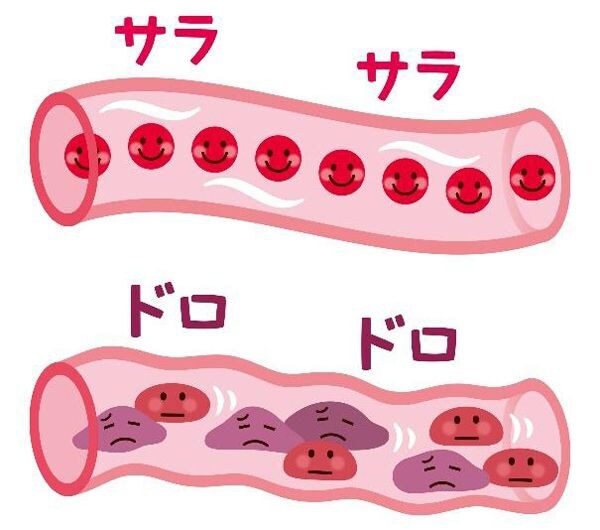 見分け方1：脱水状態になっていないか？