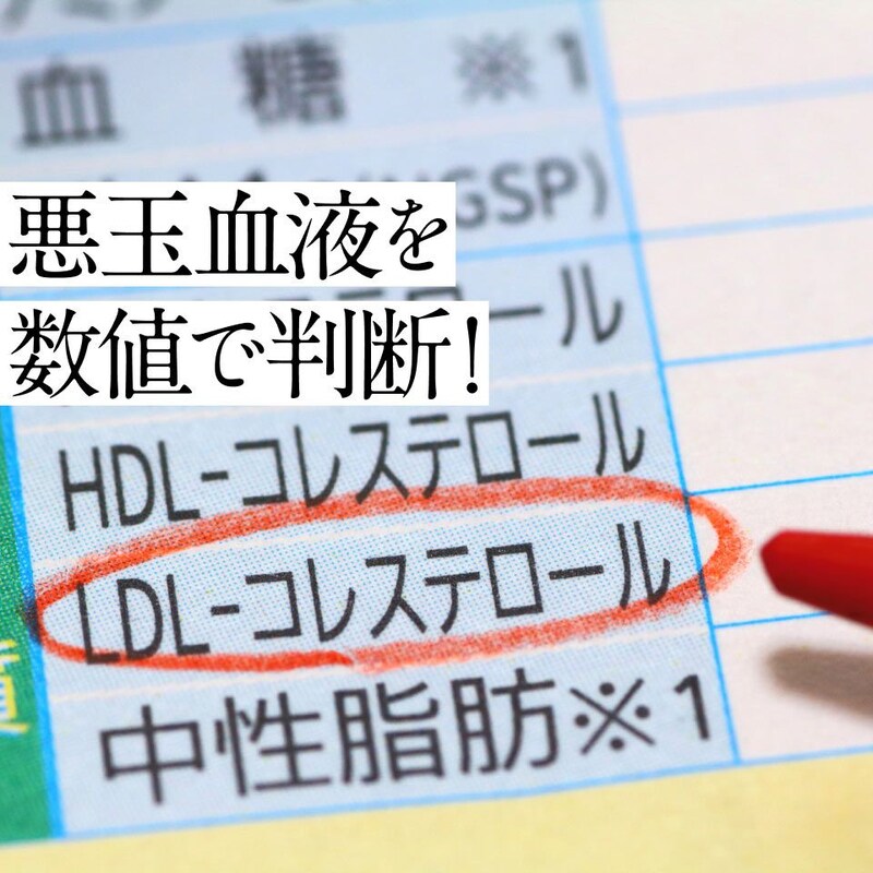 血管を傷つけるドロドロ「悪玉血液」5つの見分け方!50代からは健康診断のココを要チェック!