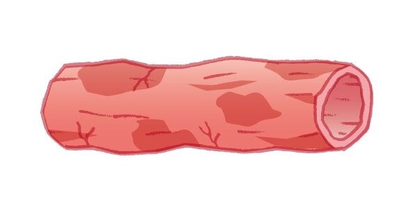 あなたの腎臓は大丈夫？「リンの取り過ぎ」で慢性腎臓病に