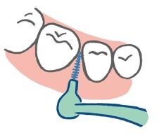 歯間ブラシの動かし方