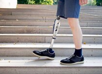 義肢装具士って何するの？仕事内容、なり方、年収などを徹底調査！