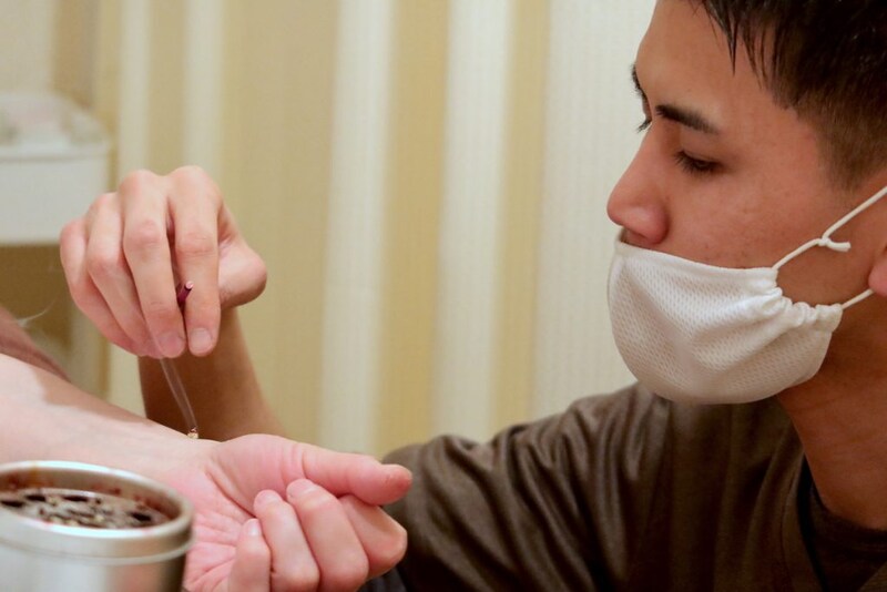 直接灸を据える久保さん