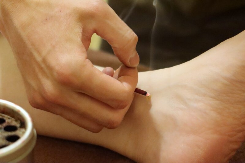 もぐさに火を点ける様子