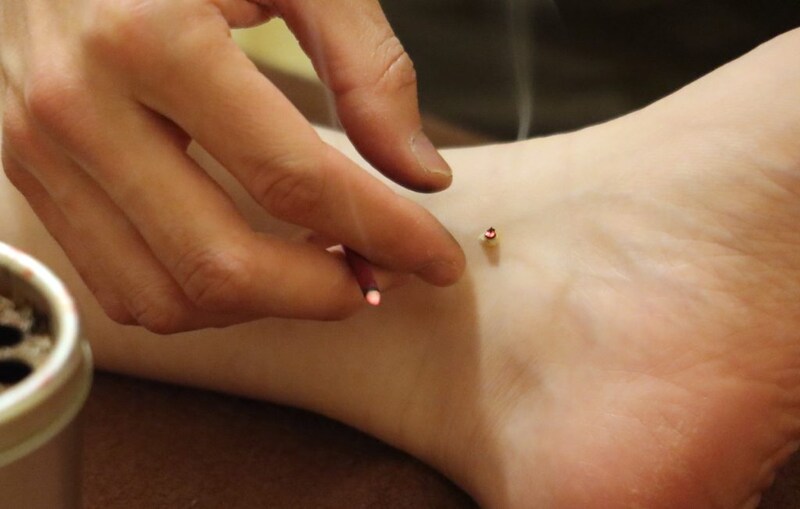 点火したもぐさが燃える様子