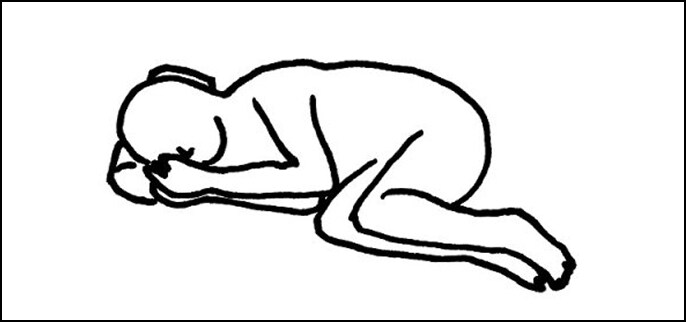 屈曲側臥位(くっきょくそくがい)