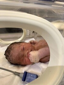 さらっと陣痛きて、さらっと産まれてくるでしょ！…が、緊急帝王切開に【たまひよ 出産体験談】