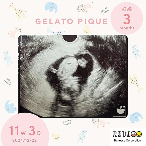 エコー写真デジタルフレーム