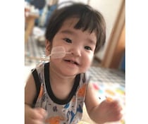 先天性の食道閉鎖でミルクが飲めない状態で誕生､生後すぐに8時間を超える手術をした赤ちゃん～新生児医療の現場から～【新生児科医･豊島勝昭】