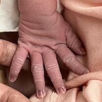 無痛分娩なのに子宮口全開までの痛みを味わうとは・・・【たまひよ 出産体験談】