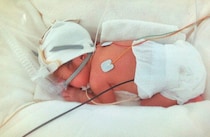 妊娠23週で気づいた少量の出血。実は母体が危険な状態だった…。「絶対に無事に産んで、家族5人で笑って過ごす」母の思い【極低出生体重児】