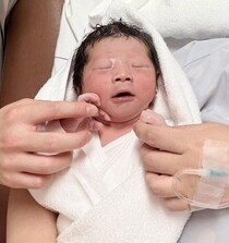 へその緒を首に2重に巻いておしゃれ気取ったわが子が誕生【たまひよ 出産体験談】