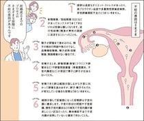 【マンガで解説】治療の流れを知ろう！不妊治療クリニック受診ガイドSTEP2［ 不妊の原因について］