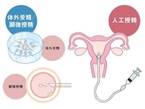人工授精・体外受精・顕微授精の方法は？　不妊治療クリニック受診ガイドSTEP4