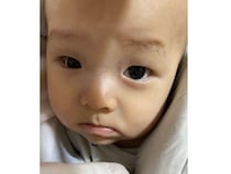 生後5カ月での右目摘出手術、そして抗がん剤治療。義眼は7個目。右目摘出から始まった義眼との生活【網膜芽細胞腫】