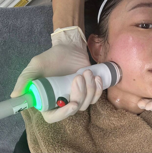 ダウンタイムなし！レーザーで行う「オンダリフティング」の【韓国在住美容ライター施術体験レポ】