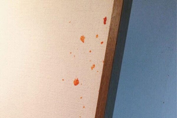 【悲劇】娘を助けようとしたパパの “優しさ” が一転…　「事件現場のような惨状」に。 9.9万いいねを集めた、あまりに切ない画像