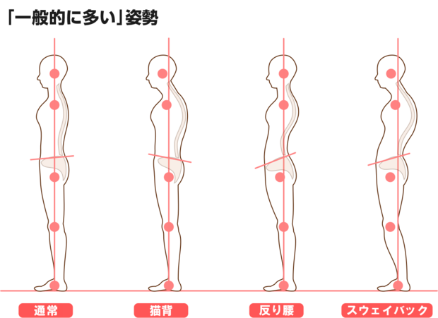 一般的に多い姿勢