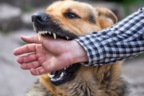 犬が『本気で噛んでくる』心理4選　主な原因や止めてほしい場合の対処法まで解説