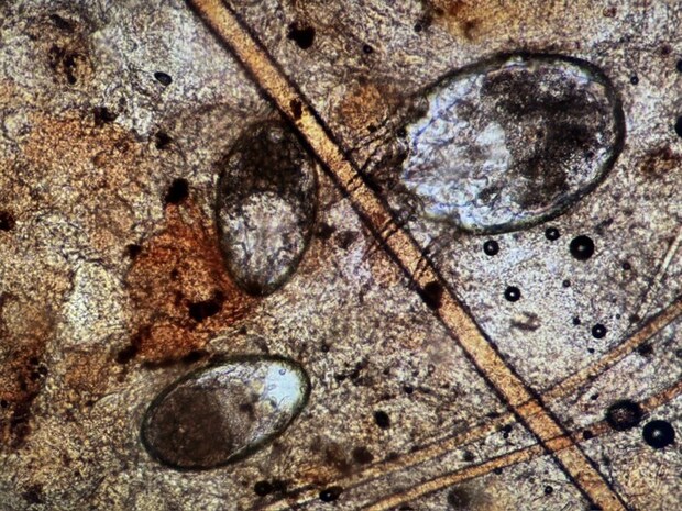 耳ダニの虫体と虫卵の顕微鏡画像