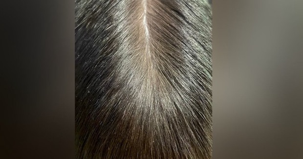 『人間の頭頂部』かと思いきや……信じられない『まさかの正体』に３万いいね「いや頭頂部でしょｗ」「とんでもない花火に見えた」