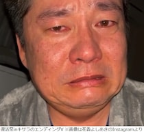 ものまねタレント・花香よしあきが5年ぶりテレビ出演「難病で4年間寝たきりだったんです」