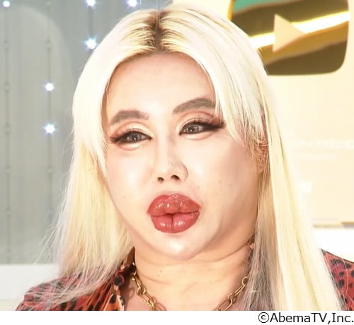 “ルッキズム時代の採用”考える、アレン様「顔採用が本当に貢献しているのか甚だ疑問」