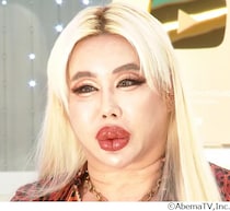 “ルッキズム時代の採用”考える、アレン様「顔採用が本当に貢献しているのか甚だ疑問」