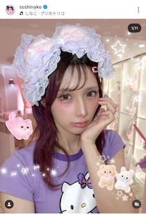 人気YouTuber・しなこ、下まぶた周辺に異変　原因は「疲労とストレス」と説明...「ゆっくり休んで」心配の声