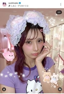人気YouTuber・しなこ、下まぶた周辺に異変　原因は「疲労とストレス」と説明...「ゆっくり休んで」心配の声