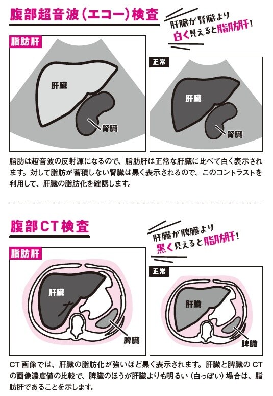 出典：『専門医が教える1分で肝臓から脂肪が落ちる食べ方決定版』（KADOKAWA）
