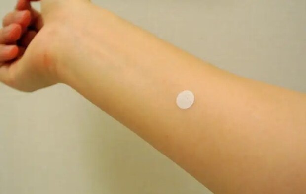 パッチテストをしている様子