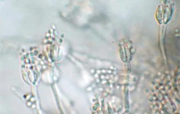 検査対象のスマートフォンのカバーケースから見つかったアオカビの顕微鏡写真（撮影：エフシージー総合研究所）