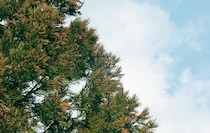 つらい花粉症、放置しないで！  知っておきたい「即効ツボ」4つ