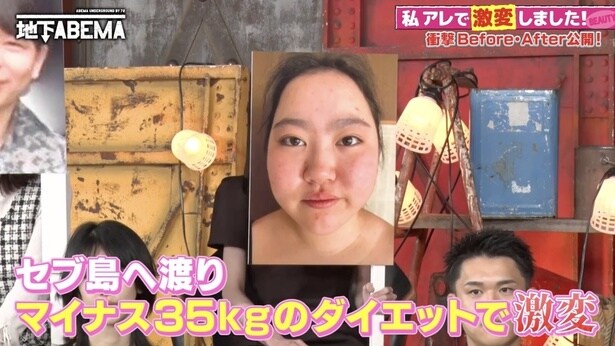 『ラストアイドル』出身元アイドル、激太りから35kg減で大変身　1日6食の“暴飲爆食生活”から“決死のダイエット留学”