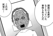 【漫画】「わずか24時間で人間の顔を白骨化させた」人間の肉を食い尽くした“小さすぎる犯人”の正体とは!?