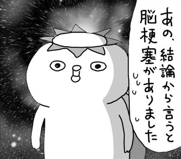 脳梗塞に気付いたきっかけは、些細な違和感だった…