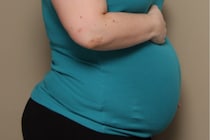 クマに襲われ頭部を噛まれた妊婦　40時間かけ大病院へ搬送