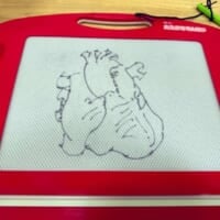 子どもに「ハート描いて」と頼まれた心臓外科医　ガチすぎる“ハート”を描き上げる