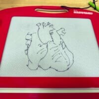 子どもに「ハート描いて」と頼まれた心臓外科医　ガチすぎる“ハート”を描き上げる