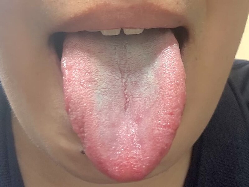1枚食べたあとの舌