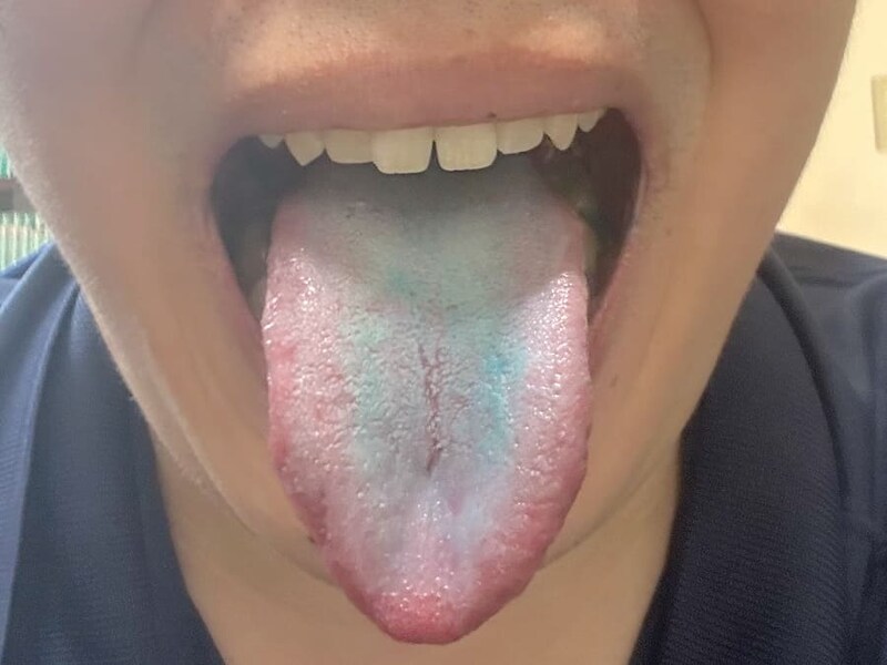 複数枚食べるとしっかり青く染まる