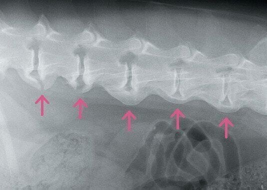 変形性脊椎症のレントゲン写真