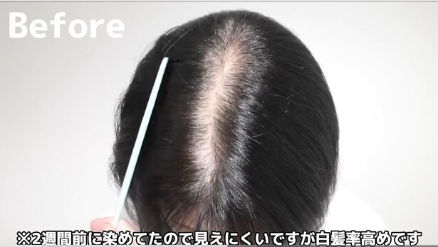 白髪と黒髪のコントラストが目立つ▶驚きのアフターは…！？（⇒次へ）