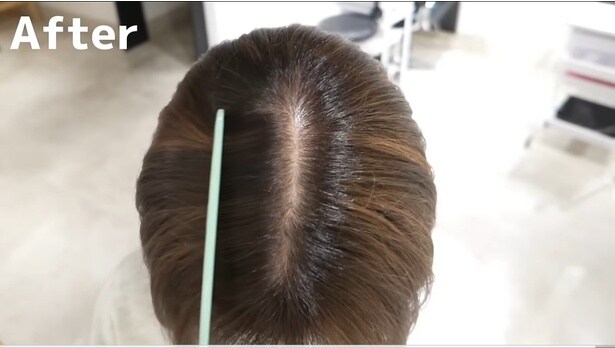 白髪も気にならず、ふわっとした頭頂部に変身！▶白髪が出やすい場所も…（⇒次へ）